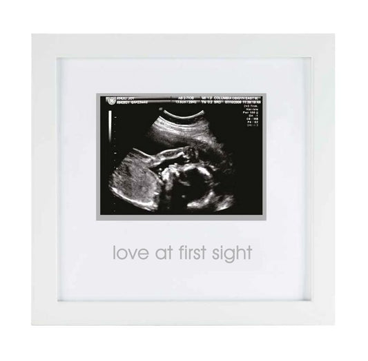 Love At First Sight Sonogram Frame, White by Pearhead Inc. Baby Gift
